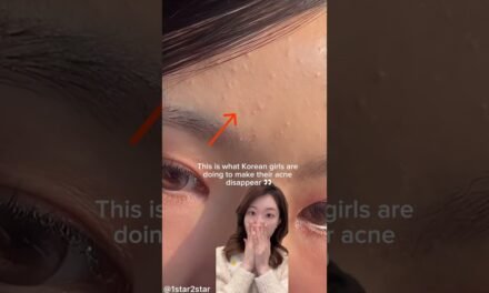How Korean girls remove acne/tiny pimples/whiteheads #shorts