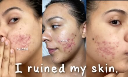 I Ruined My Skin with this Beauty Hack… #shorts #skincare