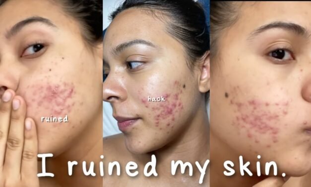 I Ruined My Skin with this Beauty Hack… #shorts #skincare