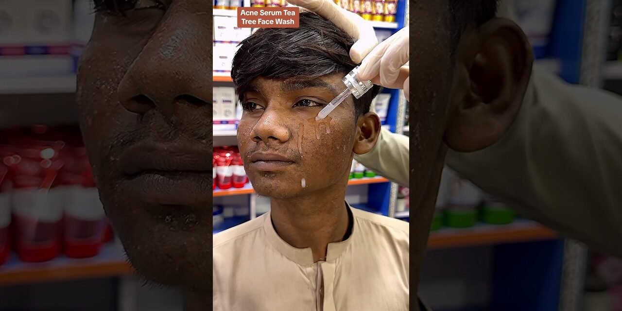 Glow & Clean Acne Serum & Tea Tree Face Wash Amazing #ameenbeautytips