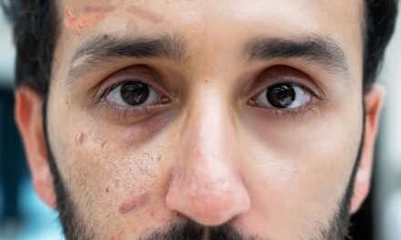 My Evidence-Based Skincare Routine