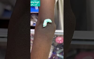 Deep Cleansing Remove Dust and Dead Skin #ameenbeautytips