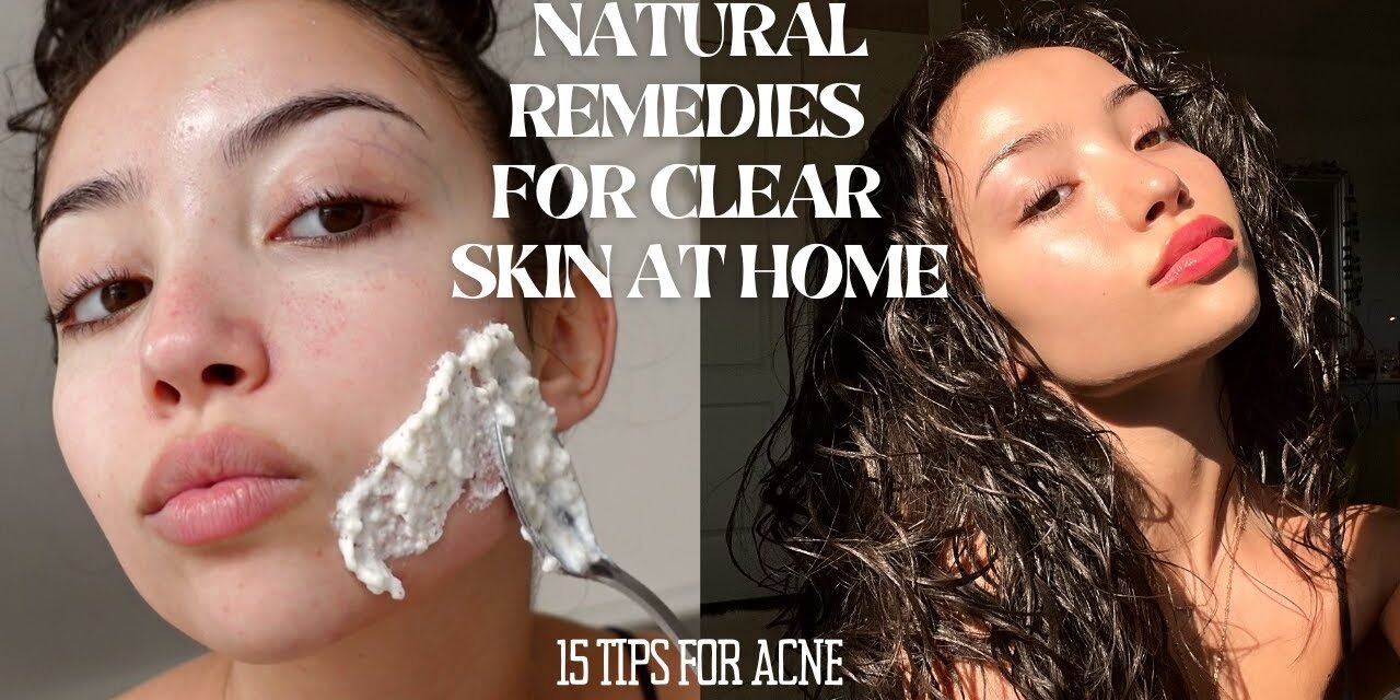HOW TO MAINTAIN CLEAR SKIN WITHOUT SPENDING MONEY | 15 tips and tricks for acne