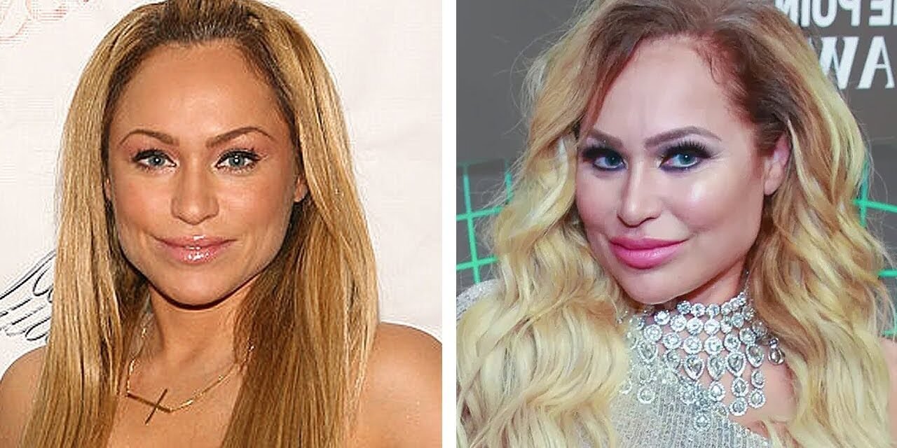 Darcey and Stacey pre and post surgery #shorts