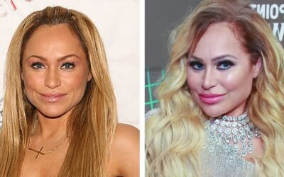 Darcey and Stacey pre and post surgery #shorts