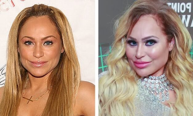 Darcey and Stacey pre and post surgery #shorts