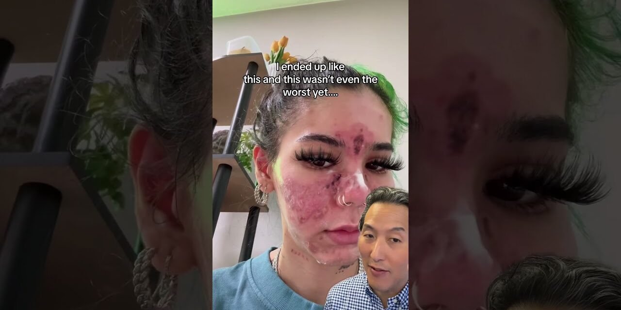 What Happens When You Apply Expired Skin Care Products!