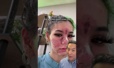 What Happens When You Apply Expired Skin Care Products!