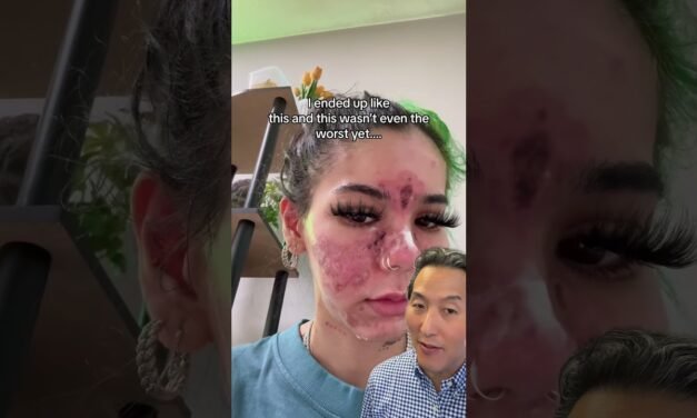 What Happens When You Apply Expired Skin Care Products!
