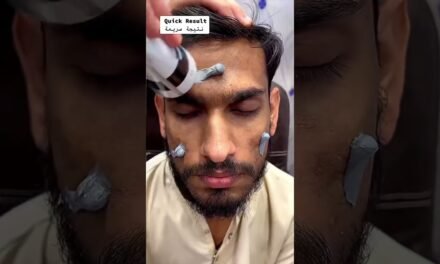 Glow & Clean Activated charcoal Face Wash #youtubeshorts