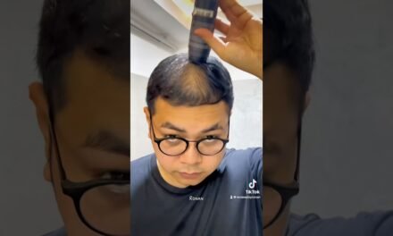 Daily Routine of Toppik Hair Fiber Powder with Applicator! #Toppik #Hair #Haircare