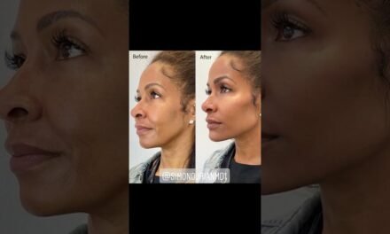 Instant, Non-Surgical Facial Contouring