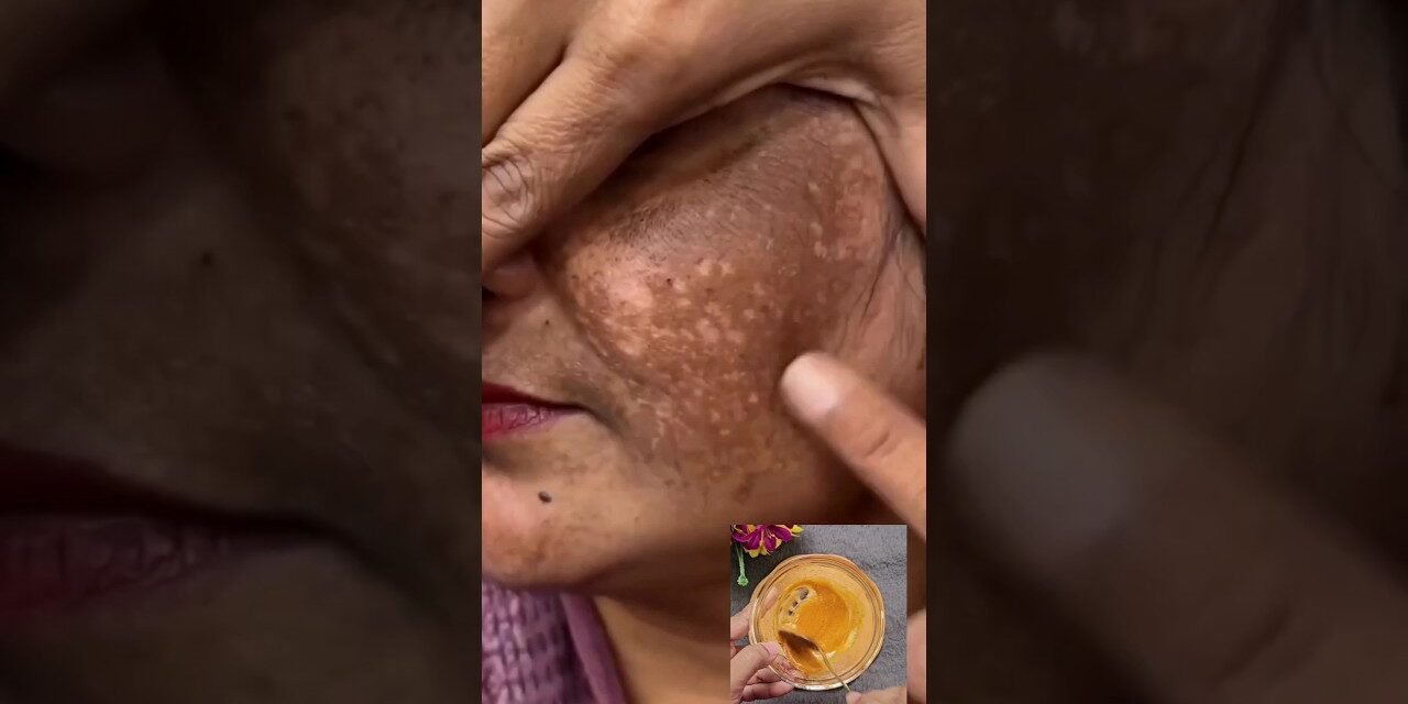 Clean Dark Spots & Pigmentation Naturally At Home | Get Glowing Skin & Remove Tanning #ytshorts