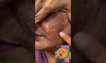 Clean Dark Spots & Pigmentation Naturally At Home | Get Glowing Skin & Remove Tanning #ytshorts