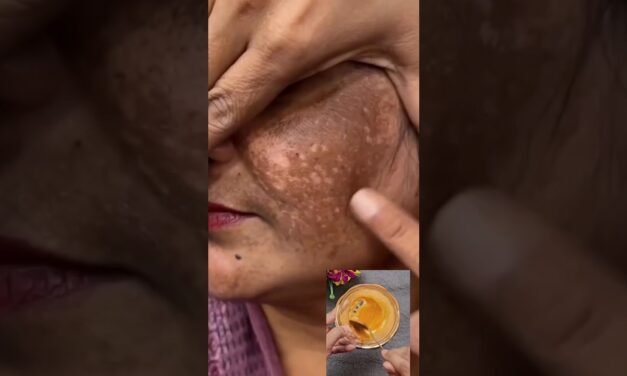 Clean Dark Spots & Pigmentation Naturally At Home | Get Glowing Skin & Remove Tanning #ytshorts