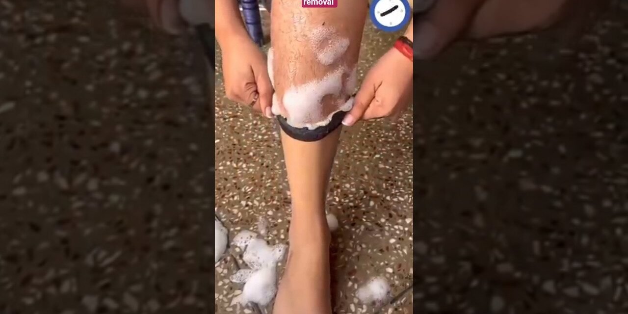 Clean Unwanted Hair At Home Easily | Easy Hair Removal Pack #trending #shortsyoutube #video #shorts