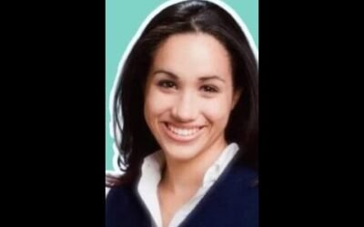 Meghan Markle's Nose Job, Botox and Veneers revealed by expert