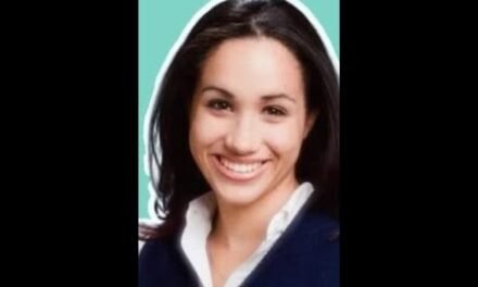 Meghan Markle's Nose Job, Botox and Veneers revealed by expert