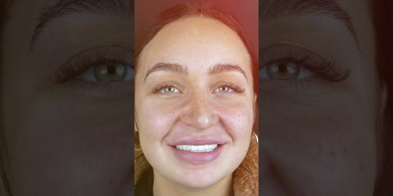Smile Makeovers for Women: Beauty at Every Age | All On Dental Clinic