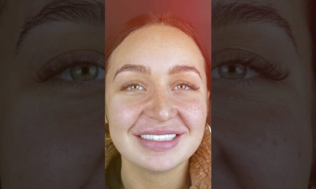 Smile Makeovers for Women: Beauty at Every Age | All On Dental Clinic